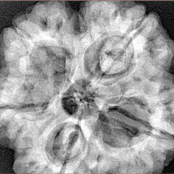 5 Mukhi Rudraksha 31.1mm 9.64gm - Xray
