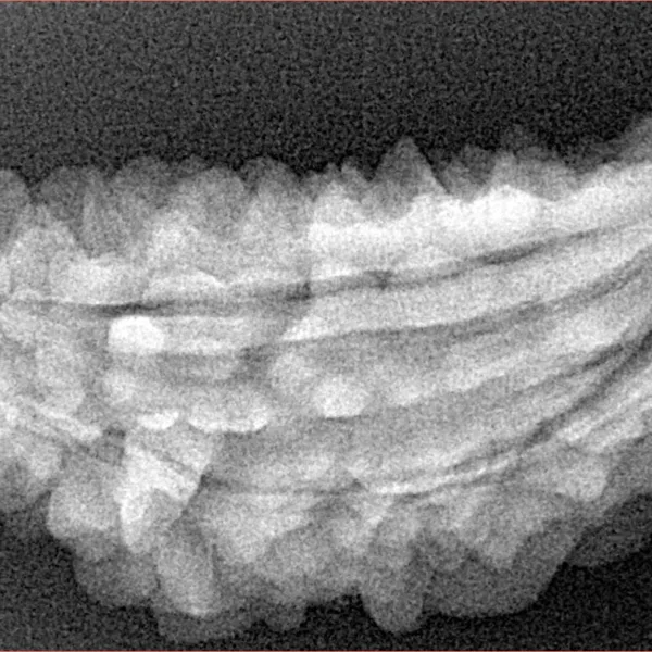 1 Mukhi Rudraksha 41.4mm 5gm - Xray