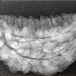 1 Mukhi Rudraksha 34.6mm 4.54gm - Xray