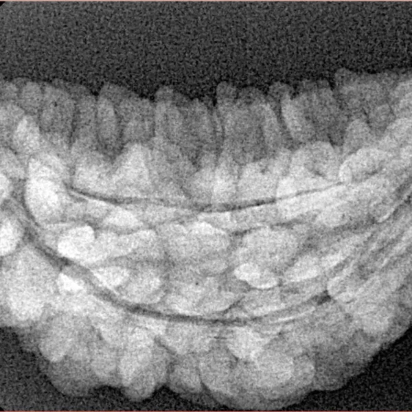 1 Mukhi Rudraksha 34.6mm 4.54gm - Xray