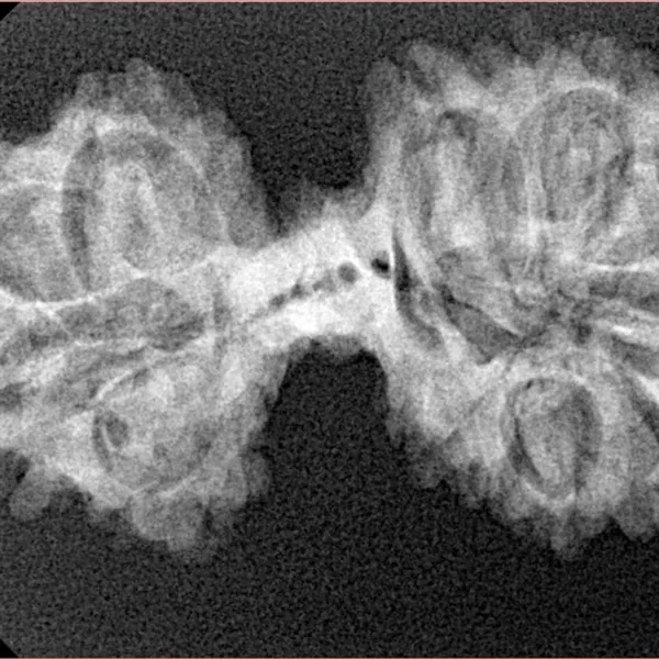 14 Mukhi Mini Trijuti 34.2mm 3.83gm - Xray