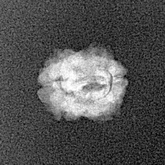 2 Mukhi Rudraksha 13.1mm 0.54gm - Xray