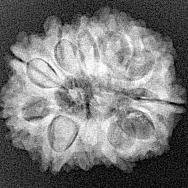 11 Mukhi Rudraksha 23.4mm 3.35gm - Xray