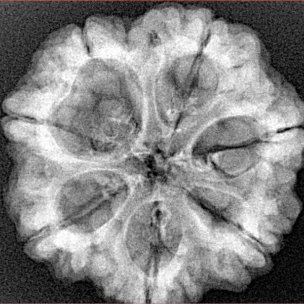 7 Mukhi Rudraksha 25.9mm 5.44gm - Xray