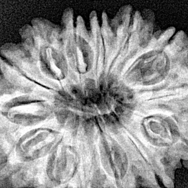 14 Mukhi Rudraksha 30.2mm 5.33gm - Xray
