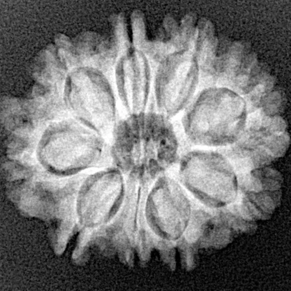 9 Mukhi Rudraksha 23mm 3.16gm - Xray