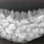 1 Mukhi Rudraksha 34.7mm 4.62gm - Xray