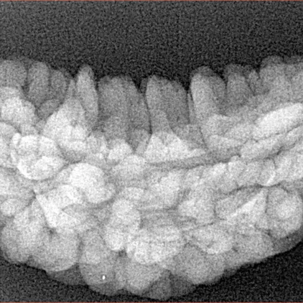 1 Mukhi Rudraksha 34.7mm 4.62gm - Xray