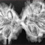 10 Mk Gaurishankar 40.2mm 7.63gm - Xray