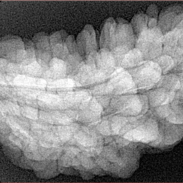 1 Mukhi Rudraksha 34.7mm 6.3gm - Xray