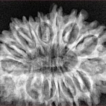 16 Mukhi Rudraksha 32.2mm 4.89gm - Xray