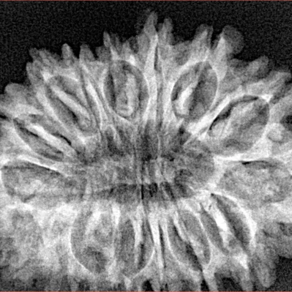 16 Mukhi Rudraksha 32.2mm 4.89gm - Xray