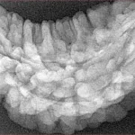 1 Mukhi Rudraksha 34.6mm 5gm - Origin: South India - Xray