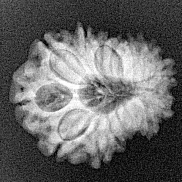 14 Mukhi Rudraksha 21.1mm 2.43gm - Xray