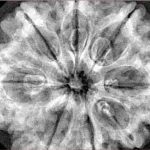 8 Mukhi Rudraksha 33mm 8gm - Xray