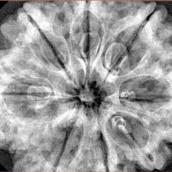 8 Mukhi Rudraksha 33mm 8gm - Xray