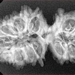 19 MK Gaurishankar 34.2mm 4.12gm - Xray