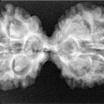 11 MK Gaurishankar 37mm 5.81gm - Xray