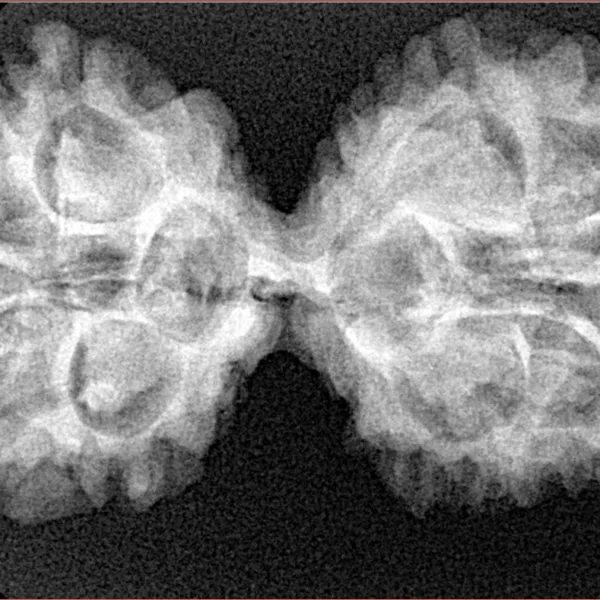 11 MK Gaurishankar 37mm 5.81gm - Xray
