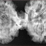 10 Mukhi Mini Trijuti 42.8mm 9.18gm - Xray