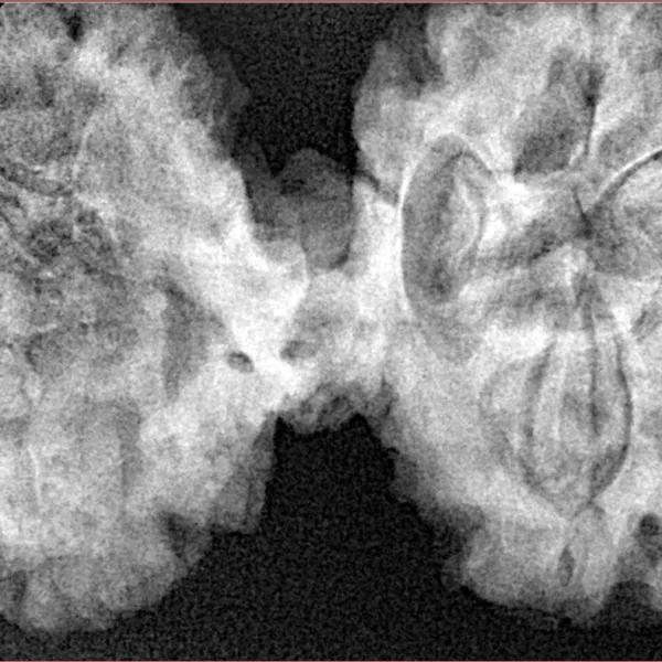 10 Mukhi Mini Trijuti 42.8mm 9.18gm - Xray