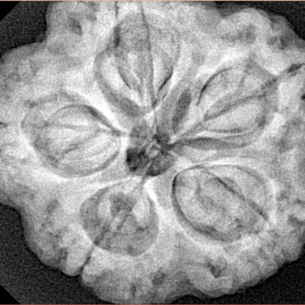 5 Mukhi Rudraksha 29.8mm 9.06gm - Xray