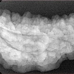 1 Mukhi Rudraksha 36.3mm 5.57gm - Xray