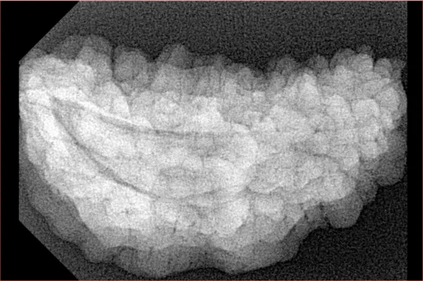 1 Mukhi Rudraksha 36.3mm 5.57gm - Xray