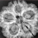 5 Mukhi Rudraksha 29.5mm 8gm - Origin: Nepal - Xray