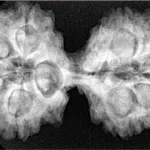 10 Mk Gaurishankar 41.8mm 8.76gm - Xray