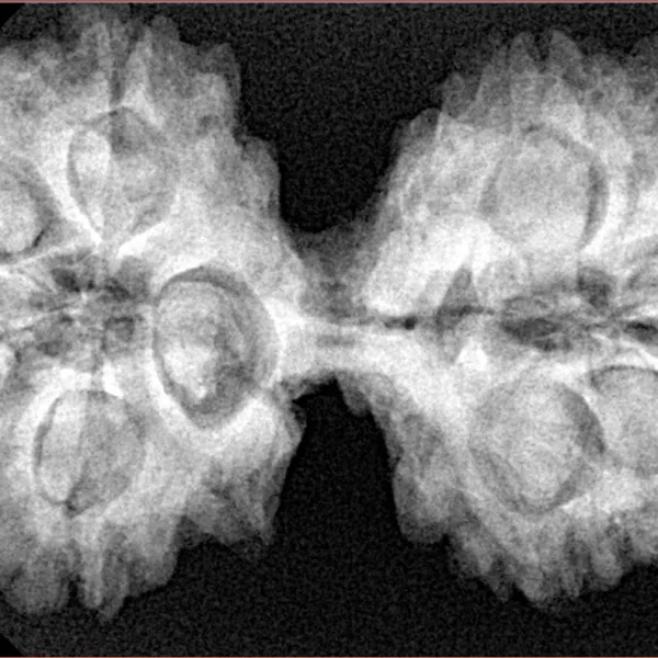 10 Mk Gaurishankar 41.8mm 8.76gm - Xray