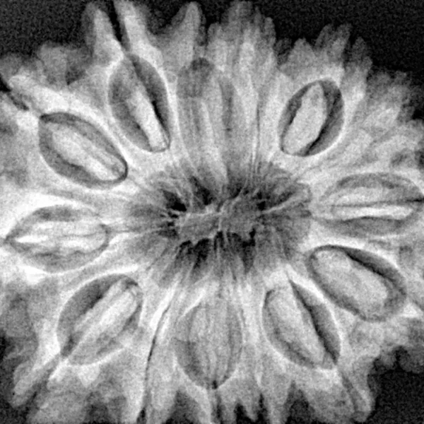 15 Mukhi Rudraksha 32.2mm 7gm - Xray