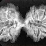 10 Mk Gaurishankar 36.1mm 6.25gm - Xray