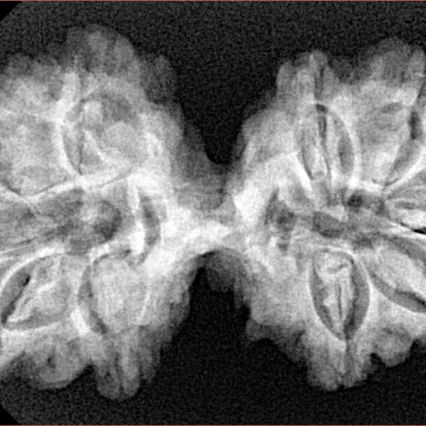 10 Mk Gaurishankar 36.1mm 6.25gm - Xray