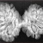 9 MK Gaurishankar 37.6mm 6.56gm - Xray