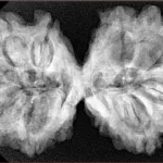 9 MK Gaurishankar 37.9mm 7.67gm - Xray