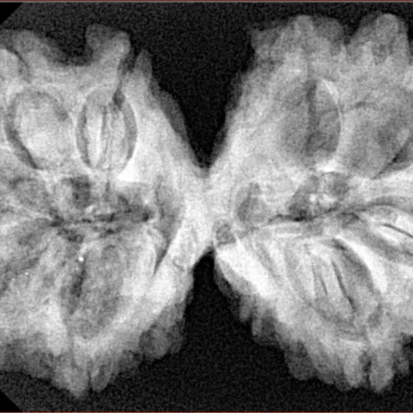 9 MK Gaurishankar 37.9mm 7.67gm - Xray