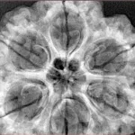 6 Mukhi Rudraksha 32.8mm 8.87gm - Xray
