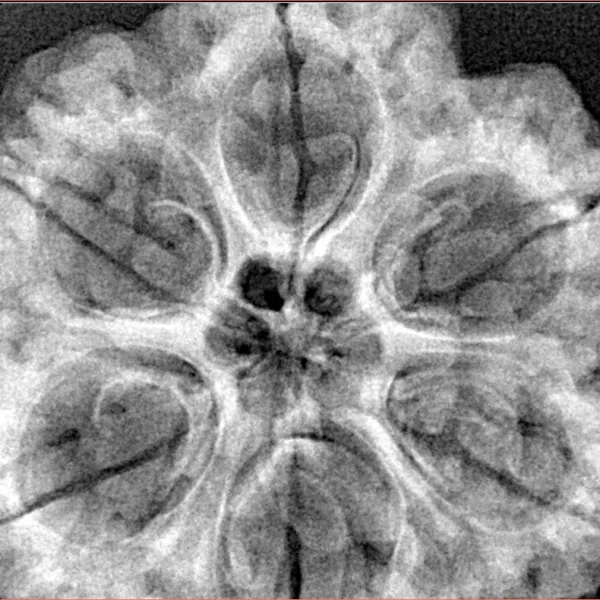 6 Mukhi Rudraksha 32.8mm 8.87gm - Xray