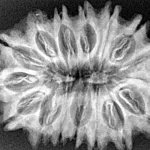 16 Mukhi Rudraksha 32.7mm 5.4gm - Xray
