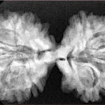 9 MK Gaurishankar 37.4mm 6.79gm - Xray