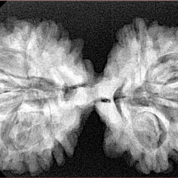 9 MK Gaurishankar 37.4mm 6.79gm - Xray