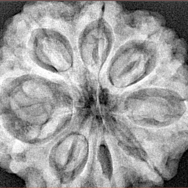 8 Mukhi Rudraksha 32.5mm 8.29gm - Xray