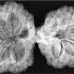 11 MK Gaurishankar 41.6mm 9.27gm - Xray