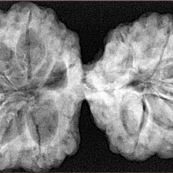 11 MK Gaurishankar 41.6mm 9.27gm - Xray