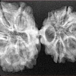 11 MK Gaurishankar 36.1mm 4.82gm - Xray