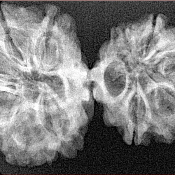 11 MK Gaurishankar 36.1mm 4.82gm - Xray