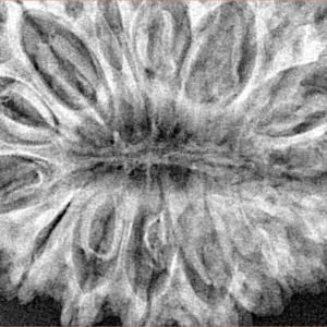 15 Mukhi Rudraksha 36.6mm 9.14gm - Xray