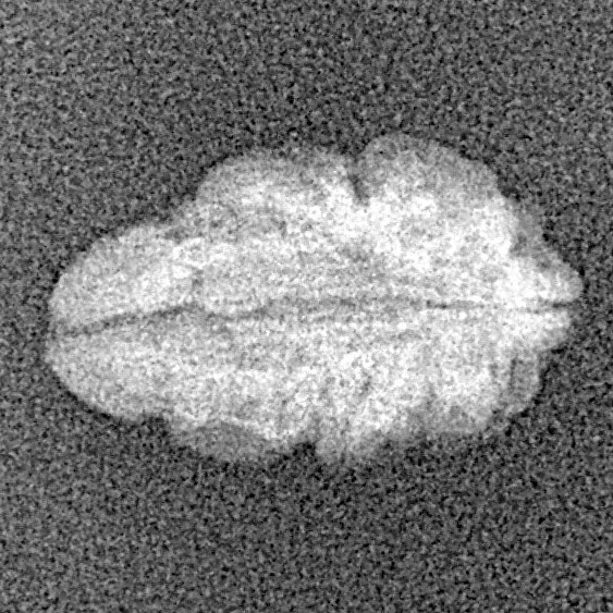 1 Mukhi Rudraksha 16.2mm 0.64gm - Xray