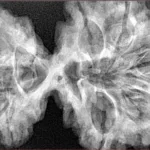 9 MK Gaurishankar 42.6mm 9.73gm - Xray